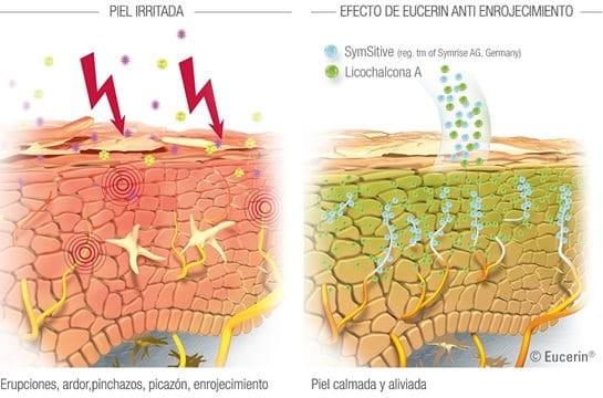 Seborrheic Keratosis On The Scalp | Ag3derm