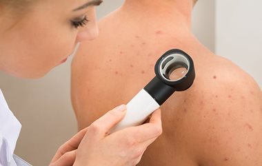 Acne doctor examines skin closely