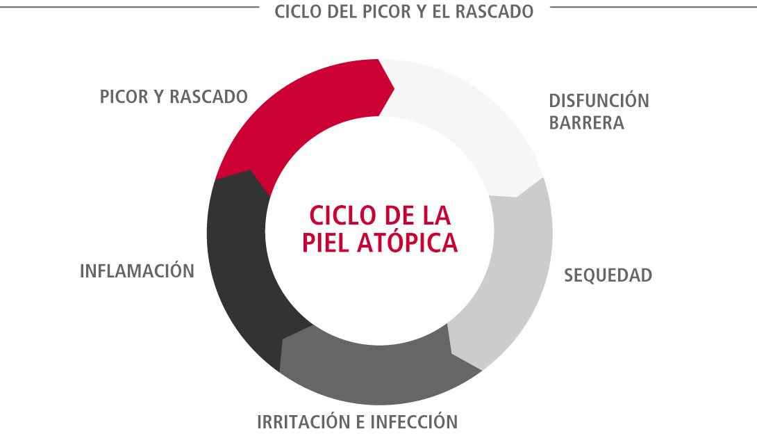 El ciclo de la piel atópica (también conocido como el ciclo de la picazón)